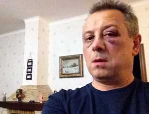 Нардепа от партии Кличко жестоко избили под Киевом