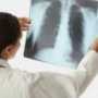 Диагноз: туберкулез в общепите. Причина: экономные хозяева