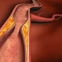 Учёные вырастили искусственные артерии