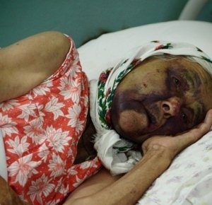 Милиция начала расследование избиения в Столице Крыма 94-летней старушки