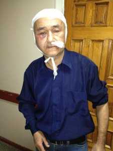Неизвестные разбили голову крымскотатарскому активисту